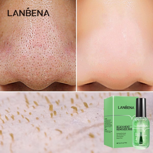 چسب بینی ضد جوش سرسیاه لانبنا