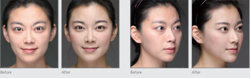 ژل نورامیس دیپ