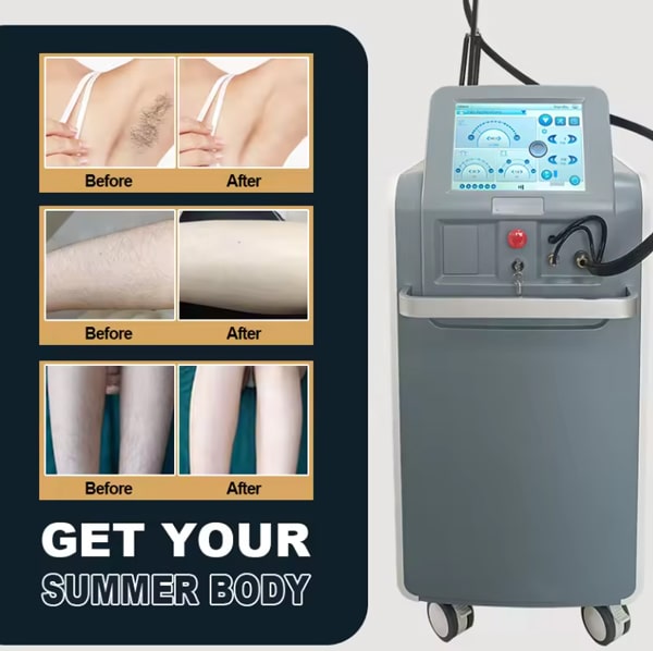 دستگاه لیزر الکساندرایت کندلا