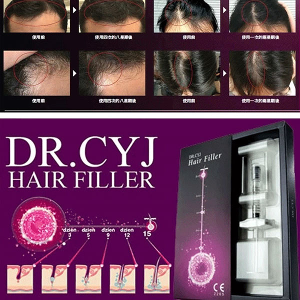 فیلر مو dr.cyj