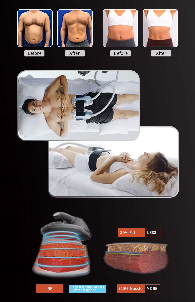 دستگاه لاغری و عضلهسازی رومیزی ای ام اسکالپت