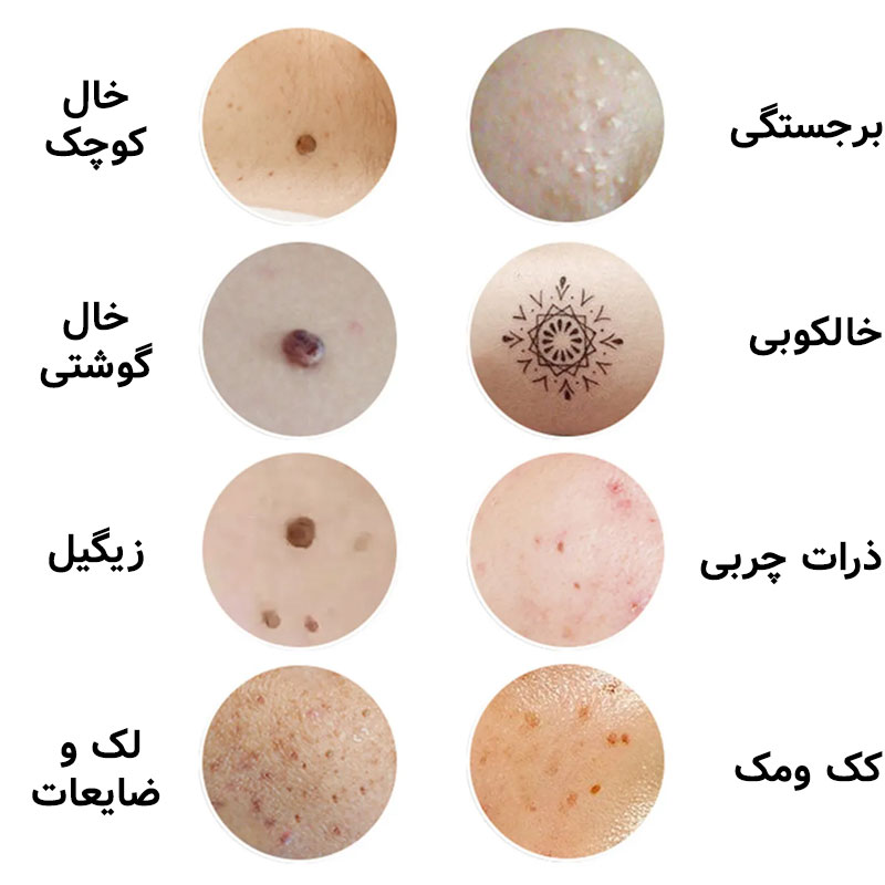 دستگاه پلاسما پن 9 قدرته Ophera